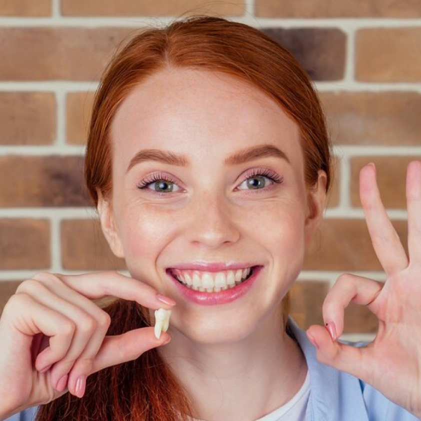 Blog posts Bonding on Front Teeth: Your Smile Solution - Oclean FAQs