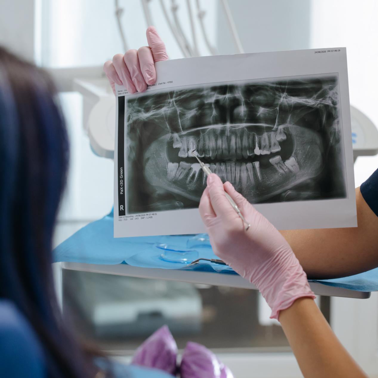 What’s An Oral Health Care Plan All about Oclean US Store