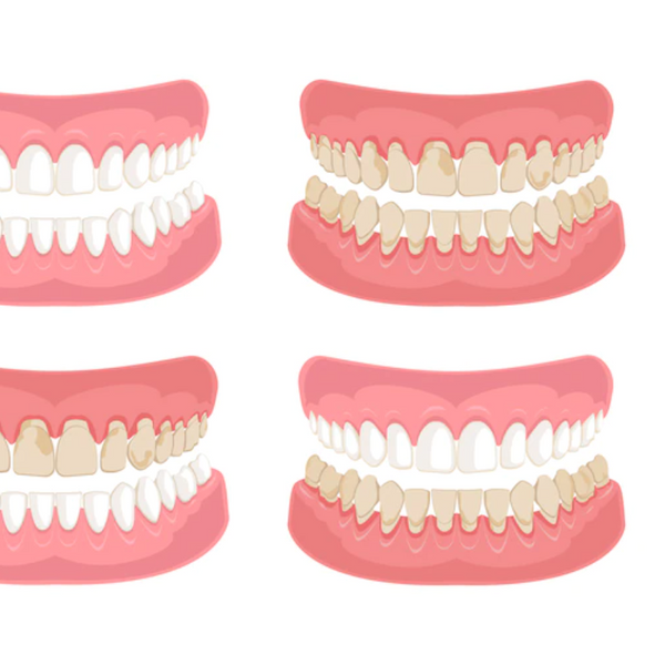 Why Does Your Teeth Stains?